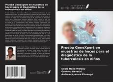 Copertina di Prueba GeneXpert en muestras de heces para el diagnóstico de la tuberculosis en niños