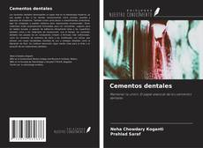 Copertina di Cementos dentales