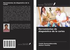 Copertina di Herramientas de diagnóstico de la caries