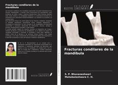 Copertina di Fracturas condilares de la mandíbula
