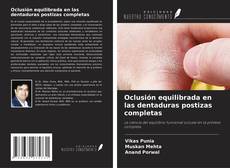 Copertina di Oclusión equilibrada en las dentaduras postizas completas