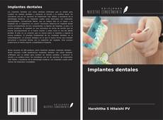 Buchcover von Implantes dentales
