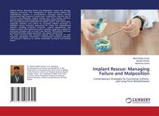 Bookcover of Implant Rescue: Managing Failure and Malposition