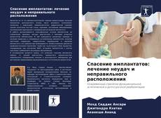Обложка Спасение имплантатов: лечение неудач и неправильного расположения