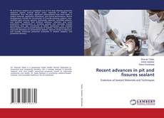 Portada del libro de Recent advances in pit and fissures sealant