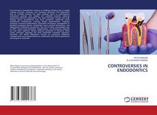 Bookcover of CONTROVERSIES IN ENDODONTICS