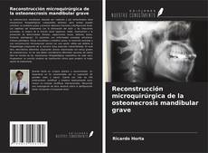 Copertina di Reconstrucción microquirúrgica de la osteonecrosis mandibular grave
