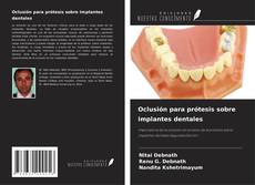 Copertina di Oclusión para prótesis sobre implantes dentales