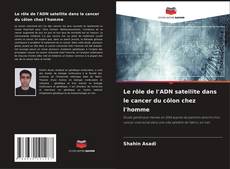 Buchcover von Le rôle de l'ADN satellite dans le cancer du côlon chez l'homme
