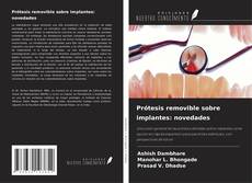 Buchcover von Prótesis removible sobre implantes: novedades