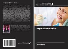 Buchcover von expansión maxilar