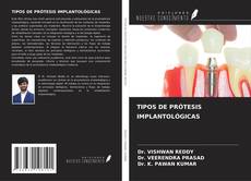 Capa do livro de TIPOS DE PRÓTESIS IMPLANTOLÓGICAS 