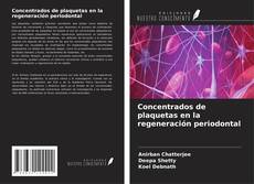 Capa do livro de Concentrados de plaquetas en la regeneración periodontal 