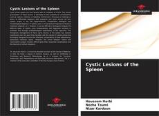 Borítókép a  Cystic Lesions of the Spleen - hoz