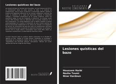 Couverture de Lesiones quísticas del bazo