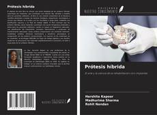 Couverture de Prótesis híbrida