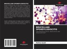 Borítókép a  BRUCELLIAN SPONDYLODISCITIS - hoz