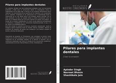 Capa do livro de Pilares para implantes dentales 