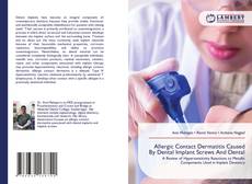 Borítókép a  Allergic Contact Dermatitis Caused By Dental Implant Screws And Dental - hoz