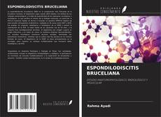 Buchcover von ESPONDILODISCITIS BRUCELIANA
