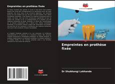 Couverture de Empreintes en prothèse fixée