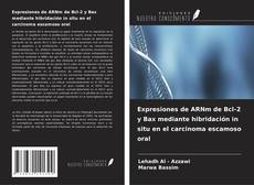 Buchcover von Expresiones de ARNm de Bcl-2 y Bax mediante hibridación in situ en el carcinoma escamoso oral