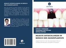 Buchcover von NEUESTE ENTWICKLUNGEN IM BEREICH DER ZAHNIMPLANTATE