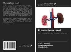 El oncocitoma renal kitap kapağı