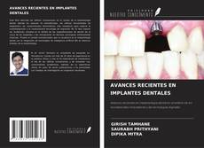 Couverture de AVANCES RECIENTES EN IMPLANTES DENTALES