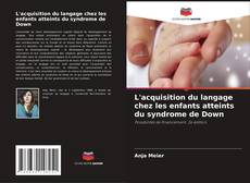 Bookcover of L'acquisition du langage chez les enfants atteints du syndrome de Down