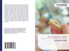 Copertina di OVERDENTURES
