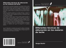 Couverture de Diferentes técnicas de obturación en los molares de leche