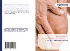Borítókép a  ILIOTIBIAL BAND SYNDROME - hoz