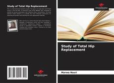 Study of Total Hip Replacement kitap kapağı