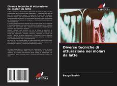 Buchcover von Diverse tecniche di otturazione nei molari da latte