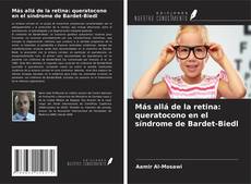 Copertina di Más allá de la retina: queratocono en el síndrome de Bardet-Biedl