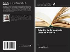 Couverture de Estudio de la prótesis total de cadera