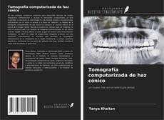 Couverture de Tomografía computarizada de haz cónico