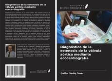 Couverture de Diagnóstico de la estenosis de la válvula aórtica mediante ecocardiografía