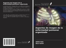Buchcover von Aspectos de imagen de la enfermedad pulmonar organizada