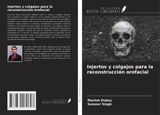 Couverture de Injertos y colgajos para la reconstrucción orofacial