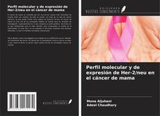 Buchcover von Perfil molecular y de expresión de Her-2/neu en el cáncer de mama
