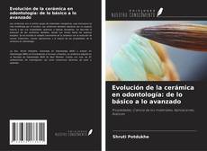 Capa do livro de Evolución de la cerámica en odontología: de lo básico a lo avanzado 