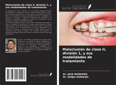 Maloclusión de clase II, división 1, y sus modalidades de tratamiento kitap kapağı