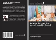 Copertina di Pérdida de superficie dental (erosión dental)