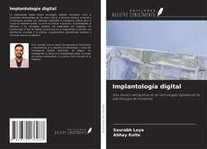 Bookcover of Implantología digital