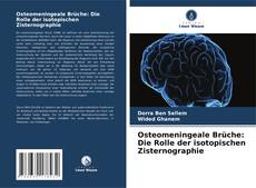 Bookcover of Osteomeningeale Brüche: Die Rolle der isotopischen Zisternographie