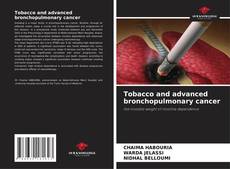 Borítókép a  Tobacco and advanced bronchopulmonary cancer - hoz