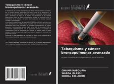 Couverture de Tabaquismo y cáncer broncopulmonar avanzado