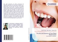 Portada del libro de The Art and Science of Cast Metal Restorations